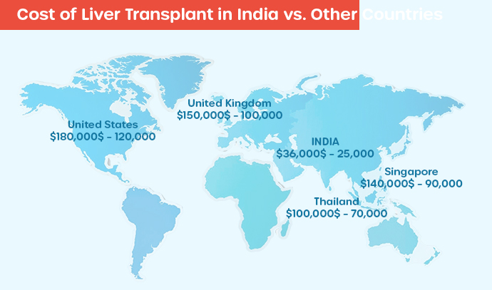 cost of liver transplant