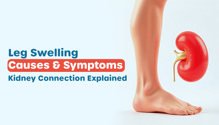 swelling in your legs