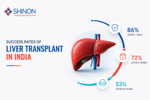 Liver transplant success rates in India showing long-term patient survival outcomes after transplantation